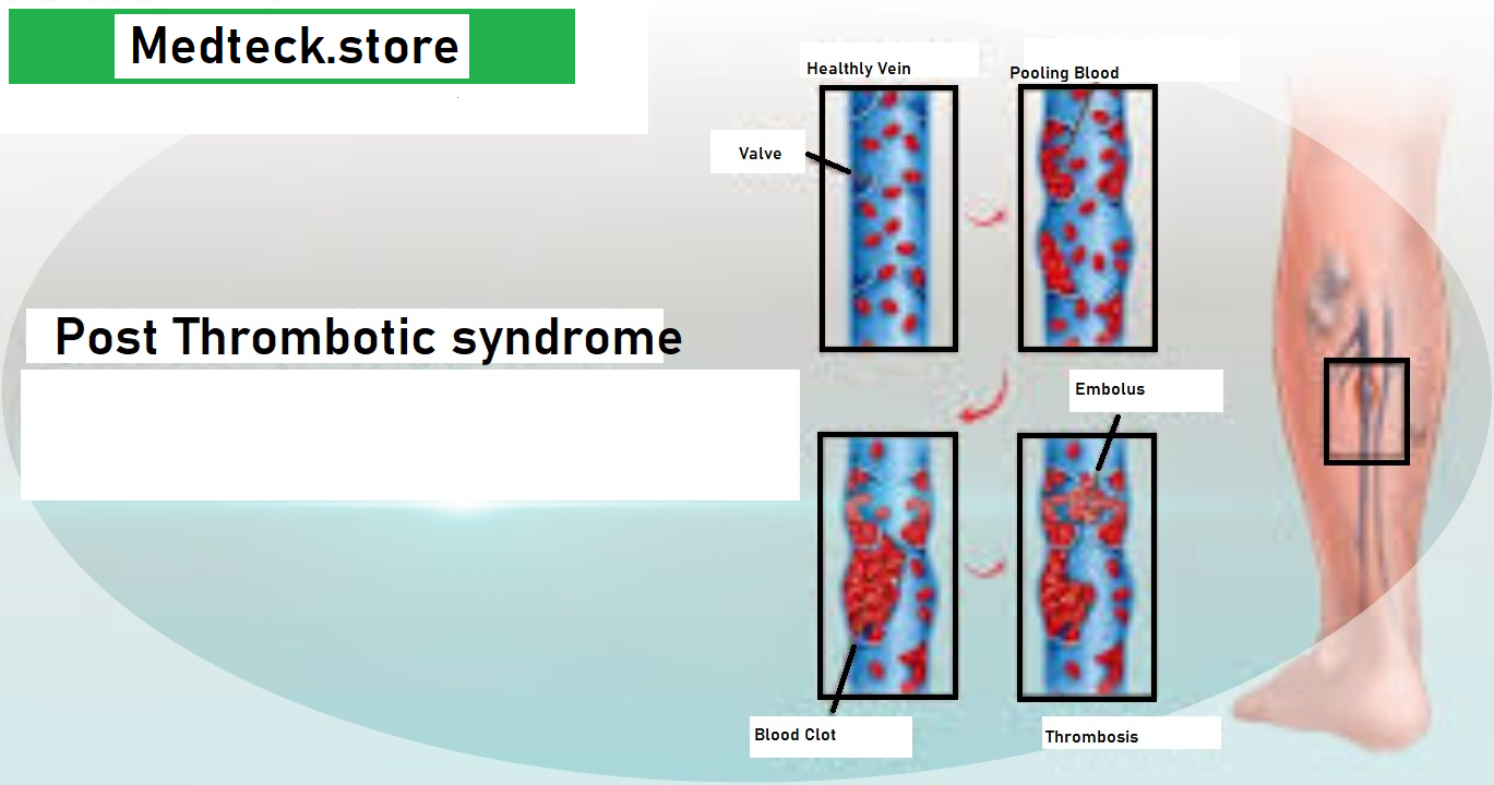 website logo venous ulcer